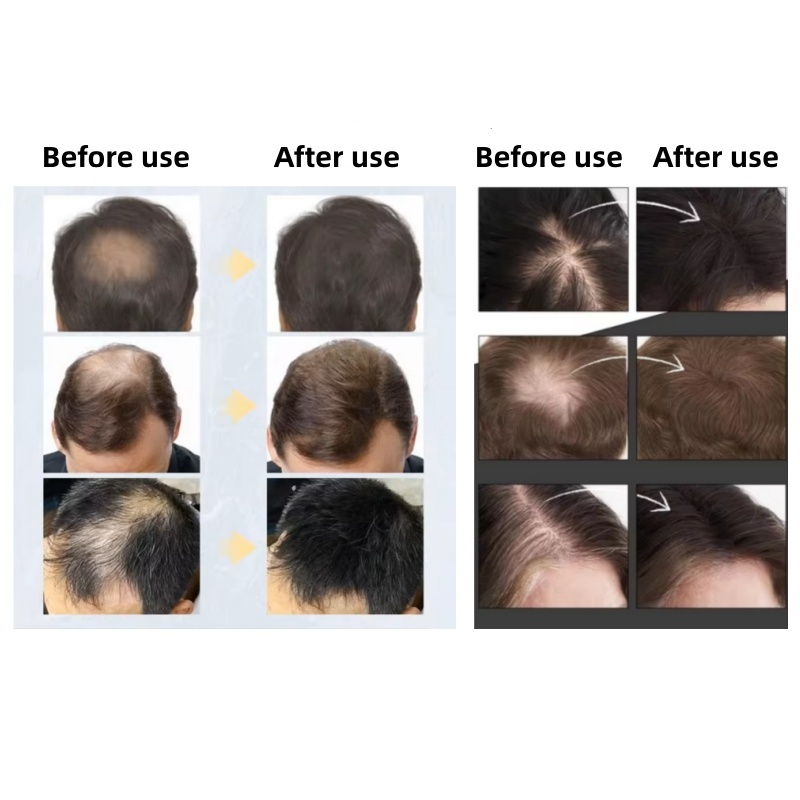 20pcsHair Fiber Keratin Hair B - Hair Care Natural Products ulasan dan harga