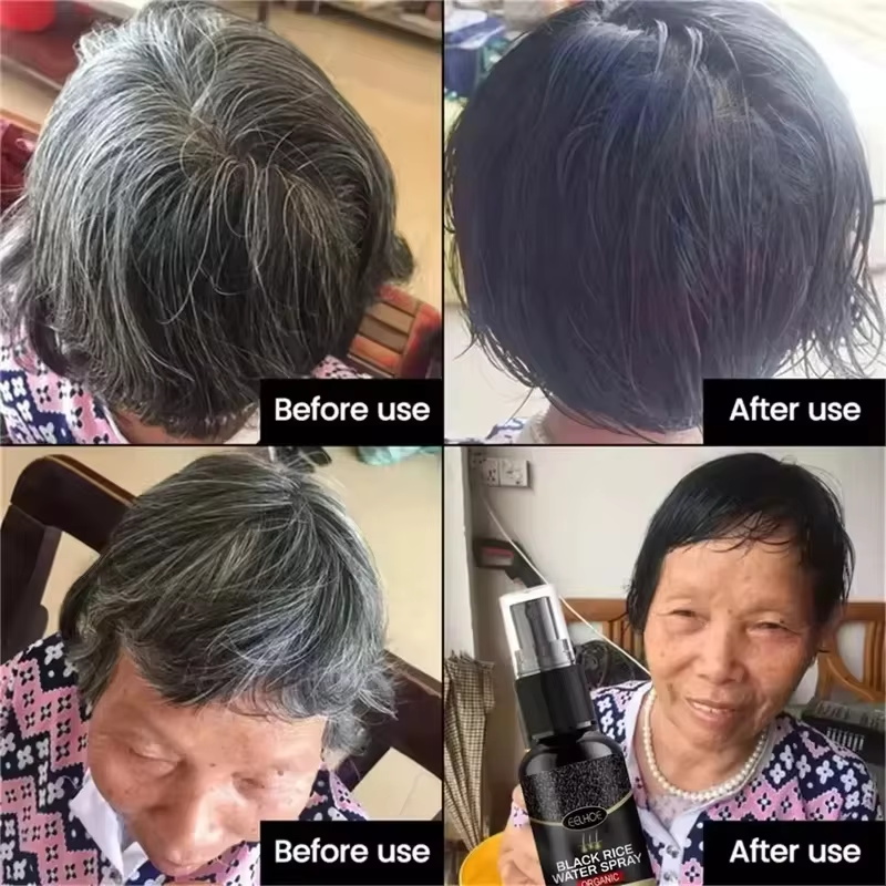 Gray White Hair Treatment Seru - Hair Care Ginseng ulasan dan harga