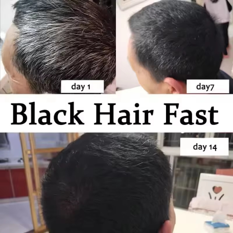 Gray White Hair Treatment Seru - Hair Care Ginseng ulasan dan harga