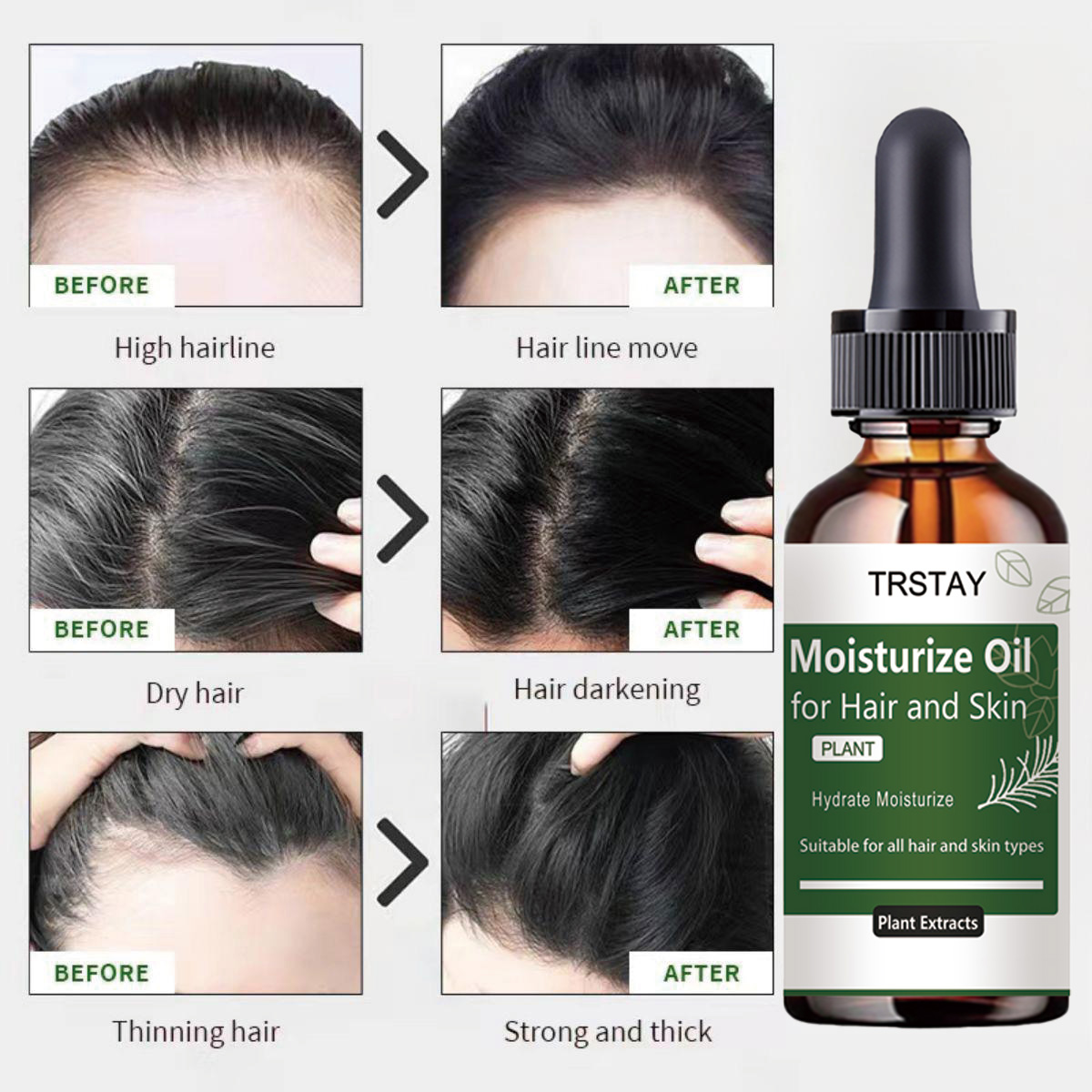 TRSTAY Rosemary Essential Oil  - Rosemary Hair Oil ulasan dan harga