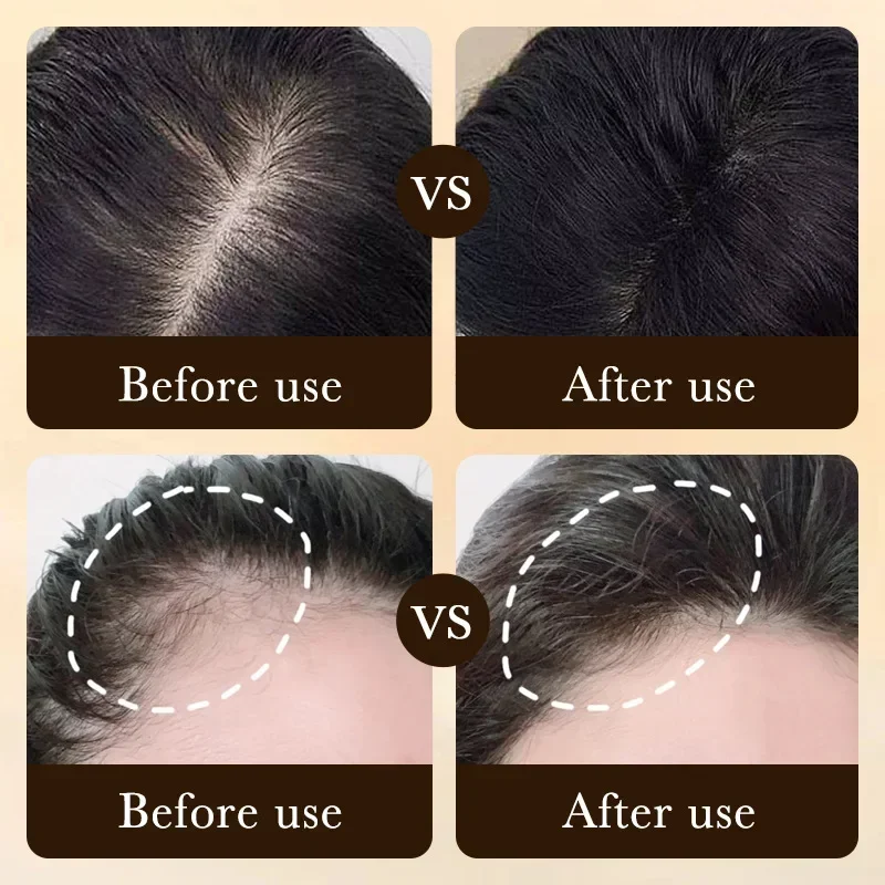 Biotin Fast Hair Growth Oil Pr - Hair Care Fragrance Essential Oil ulasan dan harga