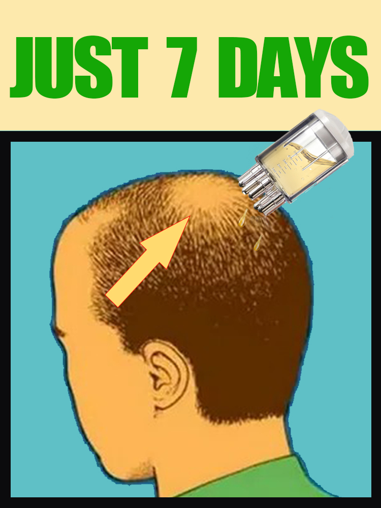 2025 NEW UPGRADE Scalp Applica - Hair Care Oil Serum ulasan dan harga