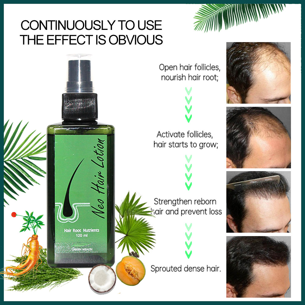 Original Neo Hair Lotion 120ml - Hair Care Thailand ulasan dan harga