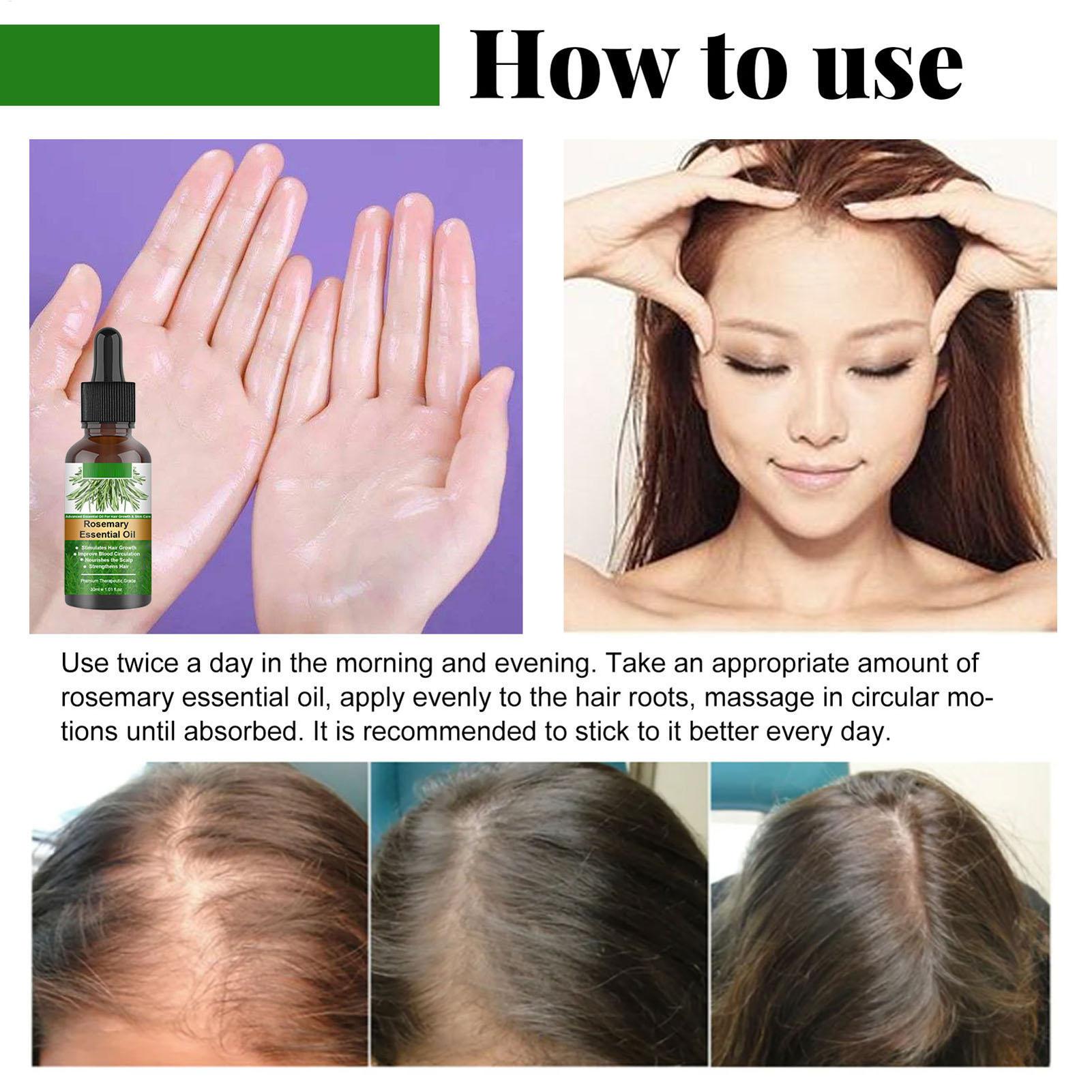 Rosemary Essential Oil Hair Gr - Hair Care Natural Products ulasan dan harga