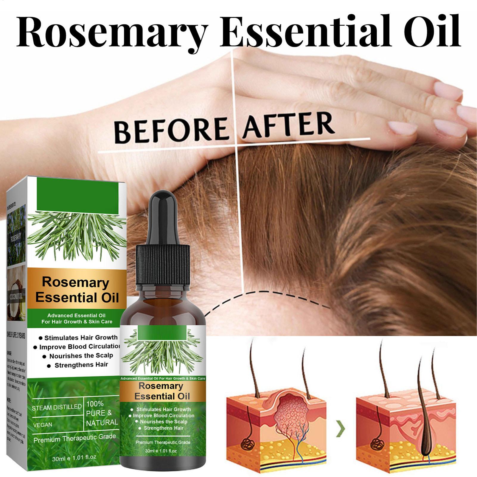 Rosemary Essential Oil Hair Gr - Hair Care Natural Products ulasan dan harga