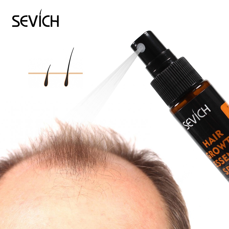 Sevich 30ml Hebal Oil Essence  - Hair Care Fragrance Essential Oil ulasan dan harga