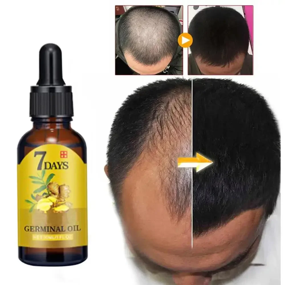 Hair Growth Ginger Fast Growin - Hair Care Fragrance Essential Oil ulasan dan harga
