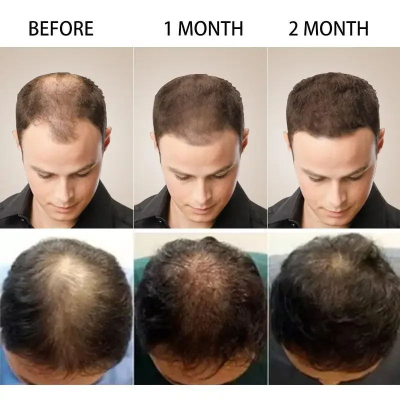 Hair Growth Ginger Fast Growin - Hair Care Fragrance Essential Oil ulasan dan harga